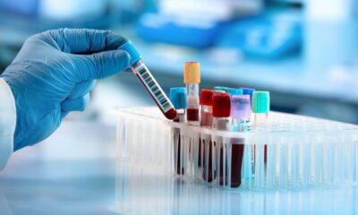 Ce medicamente influențează analizele de sânge